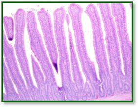 Normal small intestine